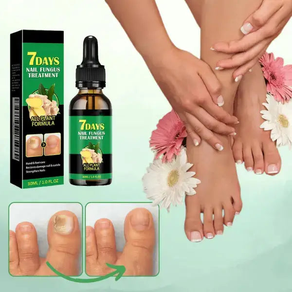 TRATAMIENTO ANTI HONGOS 7 DÍAS 100% NATURAL (1+1 GRATIS)