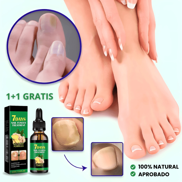 TRATAMIENTO ANTI HONGOS 7 DÍAS 100% NATURAL (1+1 GRATIS)